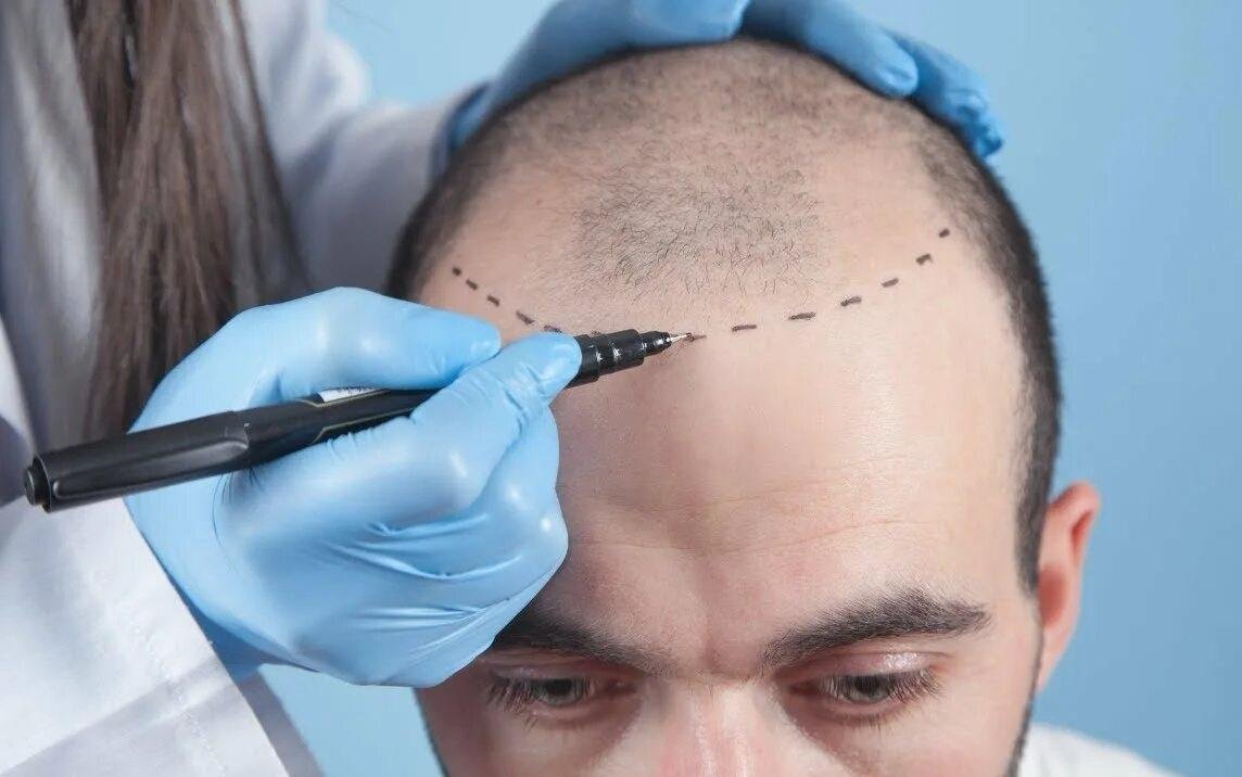 Hairline команда