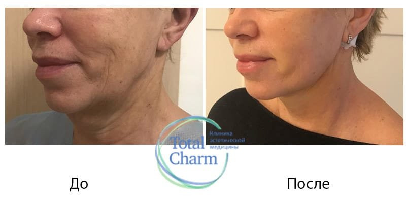 Total Charm интерьер